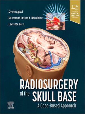 cover image of Radiosurgery of the Skull Base